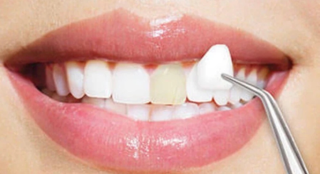 Dental Treatments at Ora Care